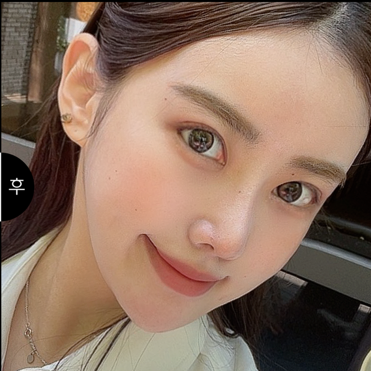 강남성형외과 눈성형 또렷한 인상을 고민한다면 확인해야 하는 부분