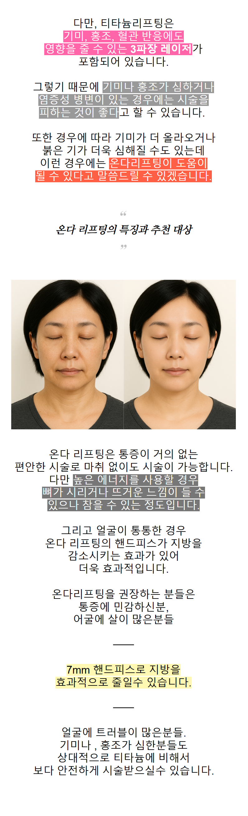 춘천온다리프팅 얼굴선 고민 전 확인해야 할 핵심 기준