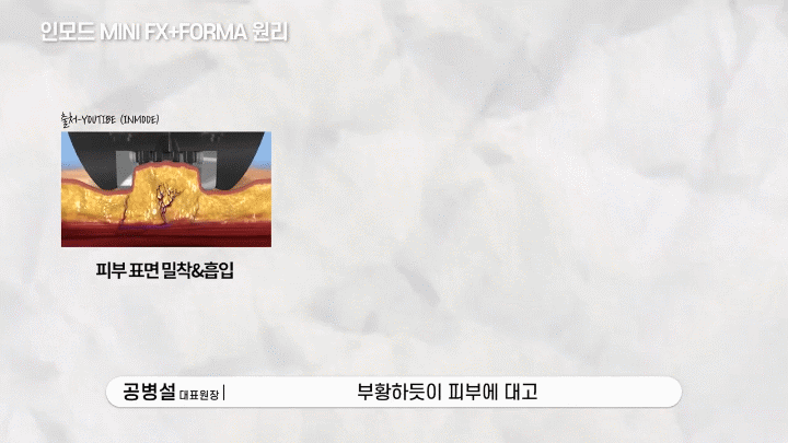 춘천인모드 얼굴선과 탄력 고민이 있다면 먼저 확인해야 할 기준