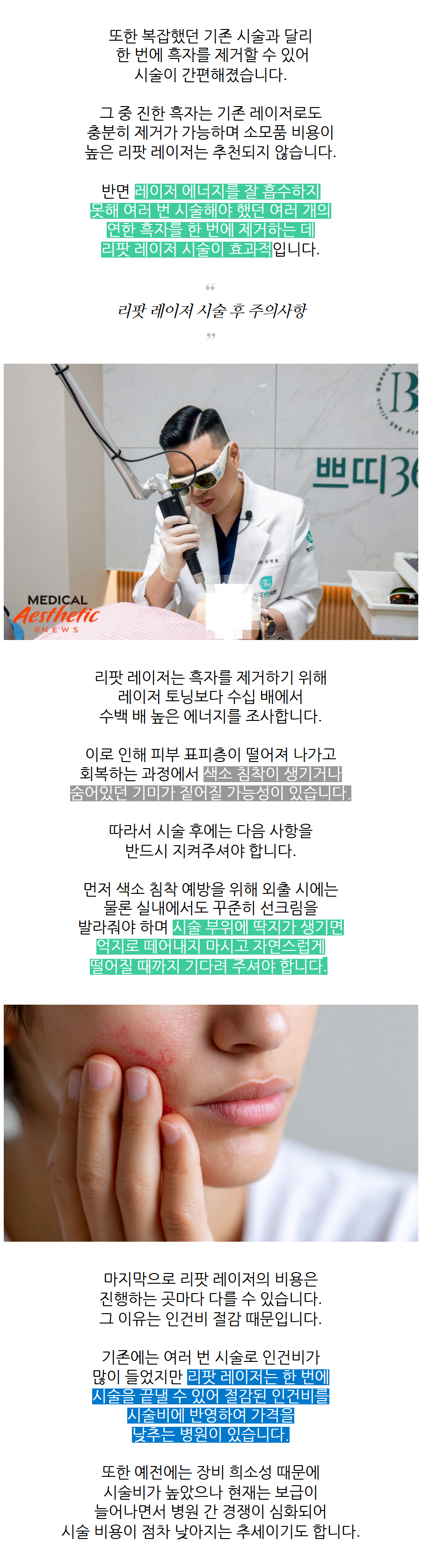 춘천피부과 기미·흑자 피코토닝
