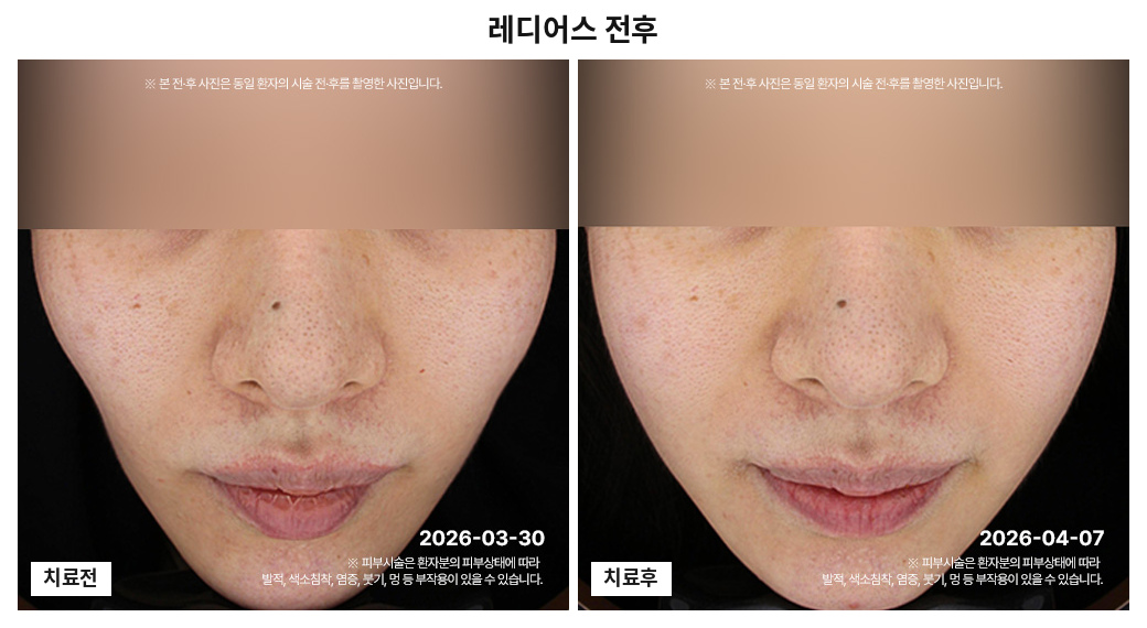 2-3.jpg